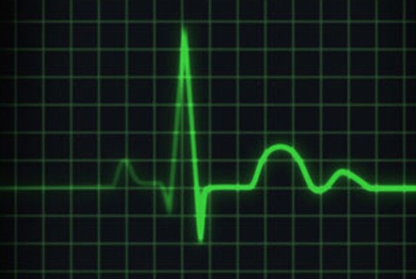 Iznenadna srčana smrt (mors subita cardialis)