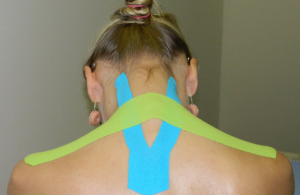 Neuromuskularni kineziotejping