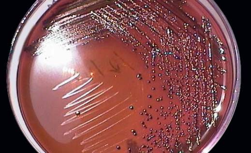 Kako ešerihija opstaje?