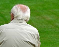 Razlozi gubitka kose kod muškaraca