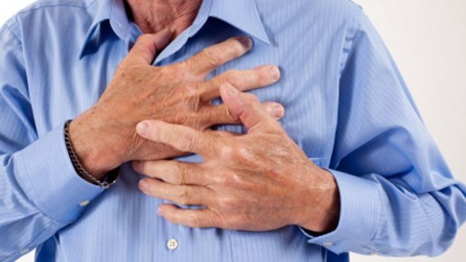 349-diabetes_srcni_infarkt_kap-d3b5ff95a458b729
