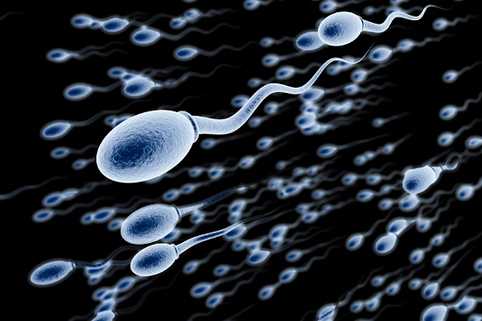 Spermogram