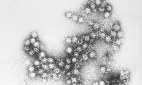 Šta je koksaki virus?