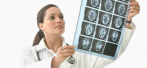 Neurologija nije bauk