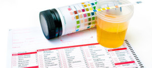 test-for-genital-herpes