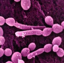 Ishranom protiv bakterije candide