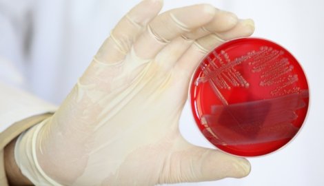 Lek protiv bakterija (posebno protiv Escherichie coli)
