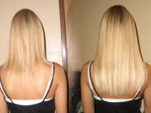 Dermatolozi preporučuju metod za brži rast kose