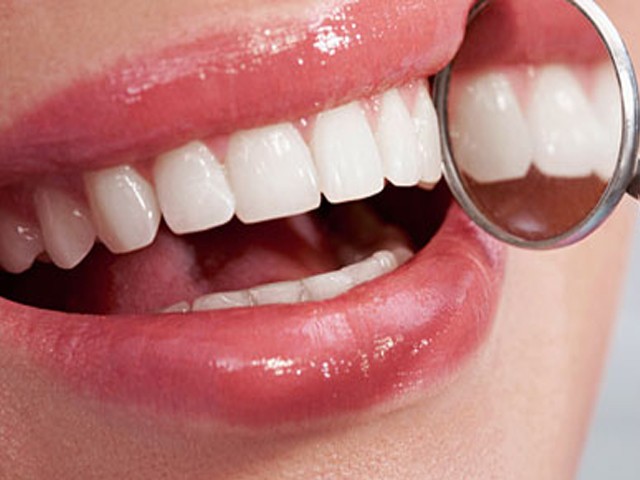 Očistite kamenac sa zuba uz pomoć ove namirnice