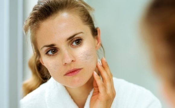 Kako se uklanjaju ožiljci od akni na licu