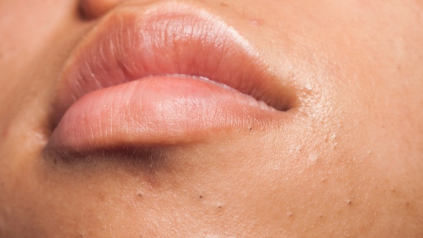 Konačno rešenje protiv mitisera