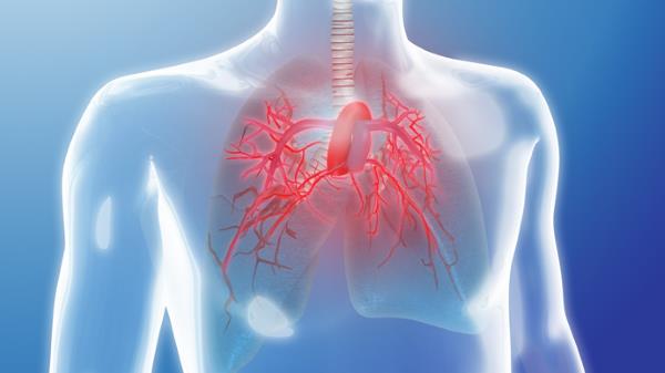 Insuficijencija zaliska plućne arterije- Simptomi i lečenje