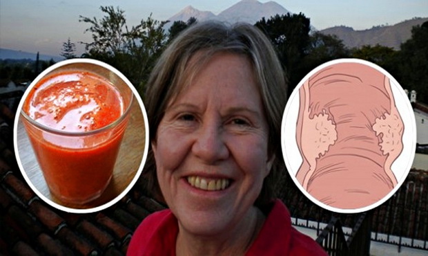 Ove žene su 2 meseca pile SVAKI DAN po čašu soka od PARADAJZA: Rezultat je čudesan!