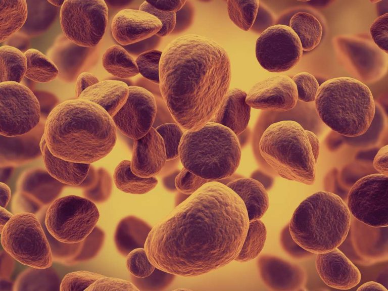 Hronična limfocitna leukemija